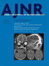 American Journal Of Neuroradiology封面