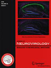 Journal Of Neurovirology封面