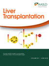 Liver Transplantation封面